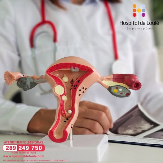 O que é a endometriose?