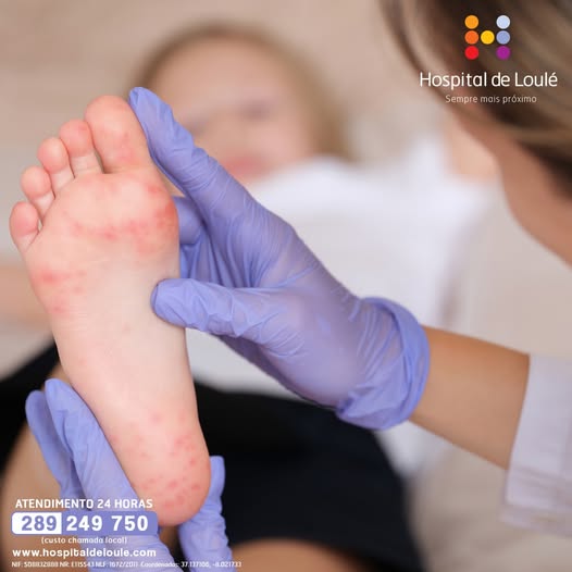 Paramyloidosis